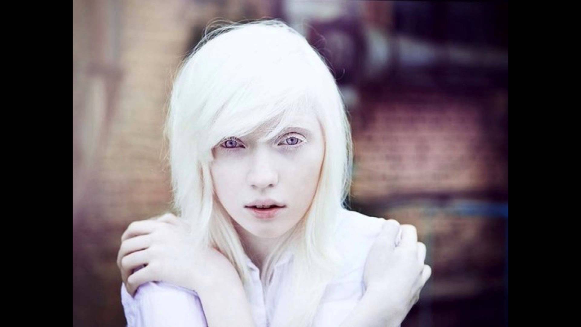 Включи белыми глазами. Настя Жидкова (Nastya Zhidkova). Настя Жидкова модель. Настя Жидкова альбинос.