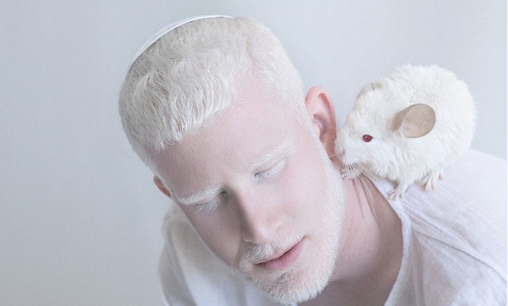 Человек с самой светлой. Rosie Crawford альбинос. Шимон альбинос.
